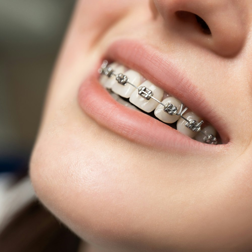 Woman with braces