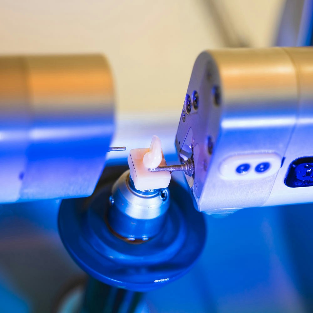 CEREC machine creating a tooth