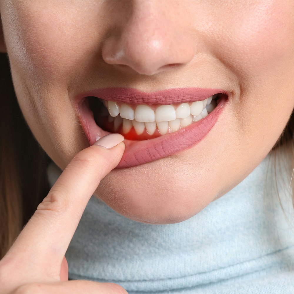 a woman with inflamed gums