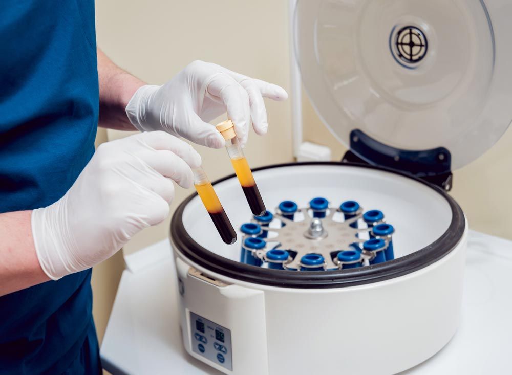Centrifuge containing PRF