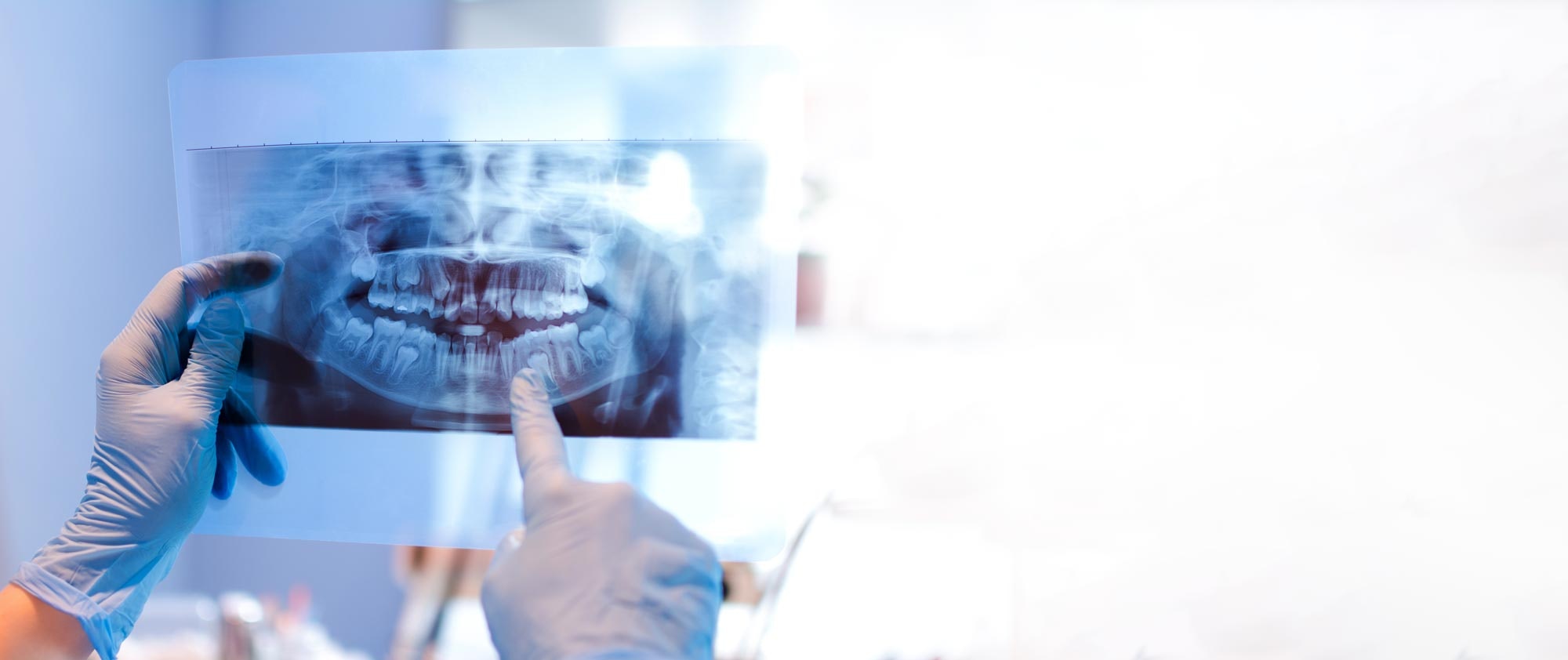 Dental xray