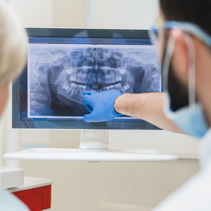 Closeup shot of dental tools
