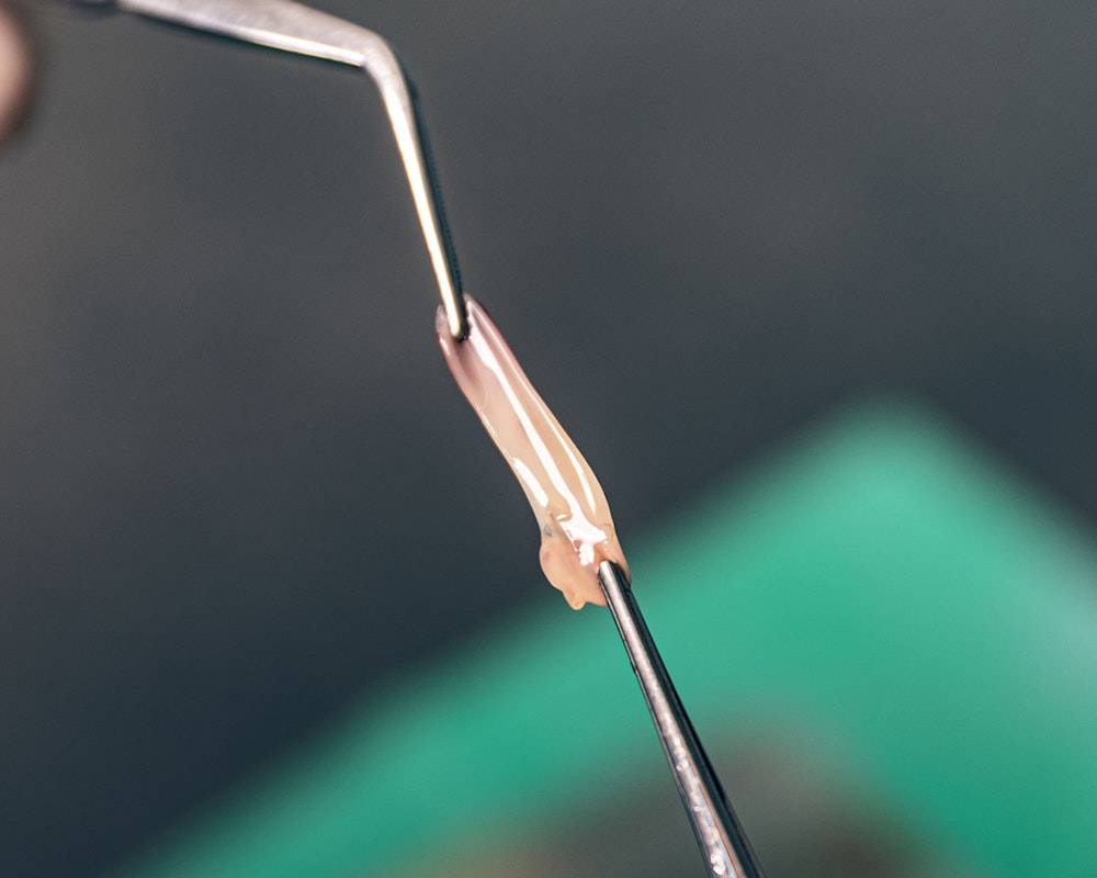 Dental graft