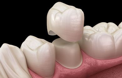 Dental crown