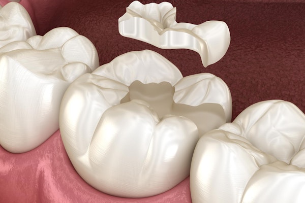 Porcelain Filling