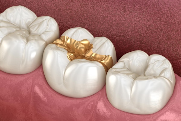 gold filling