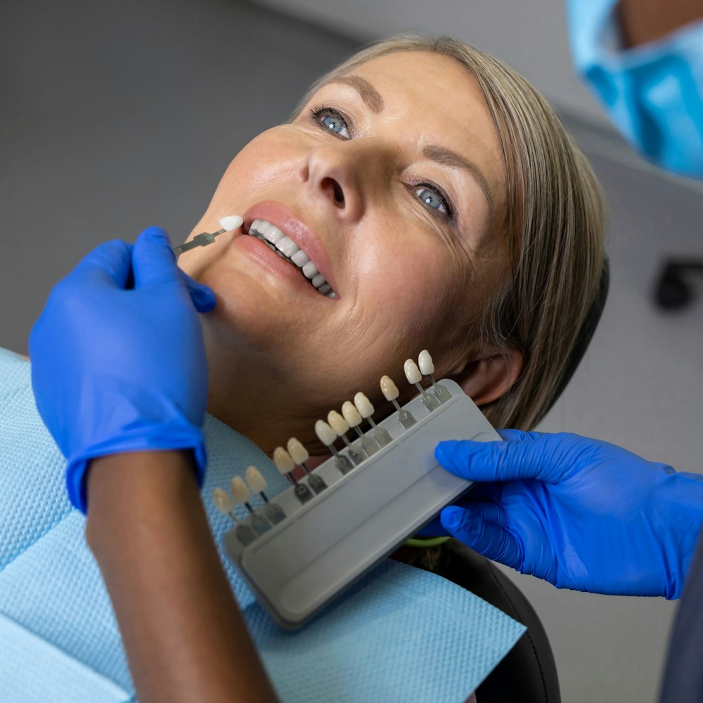 Veneer shade being compared to teeth