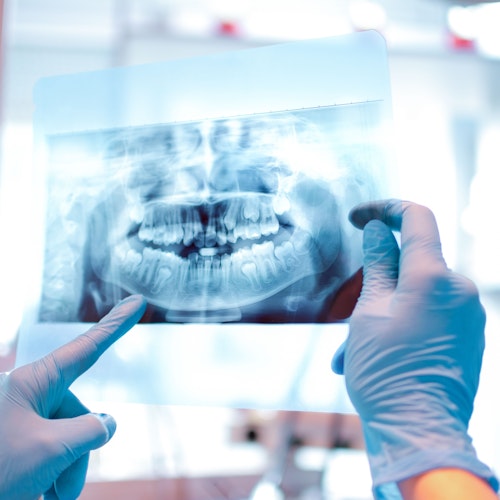 A dentist looking at x-ray images